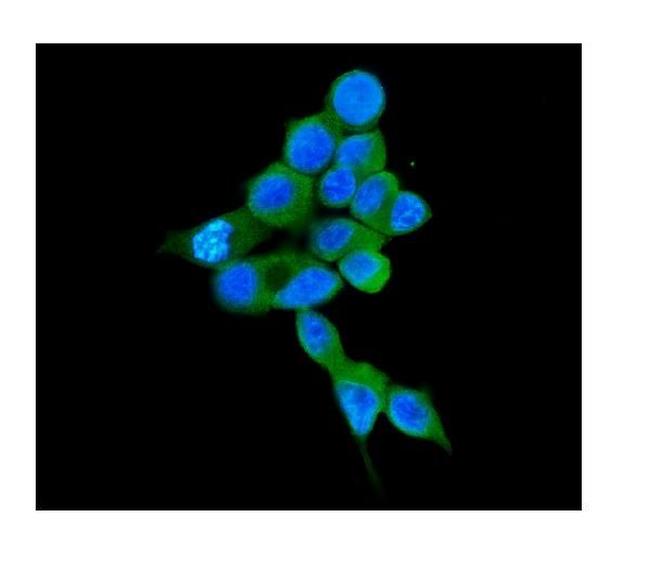 COMT Antibody in Immunocytochemistry (ICC/IF)