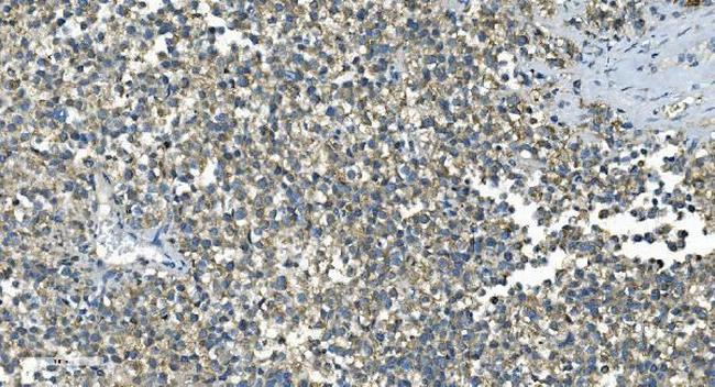 IDH2 Antibody in Immunohistochemistry (Paraffin) (IHC (P))