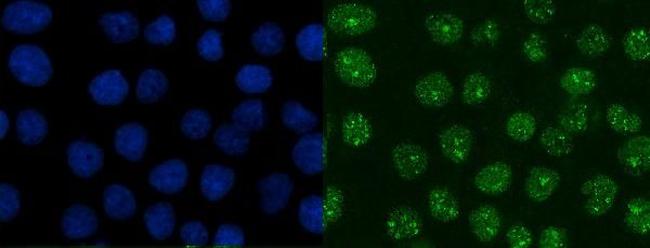 XRCC1 Antibody in Immunocytochemistry (ICC/IF)