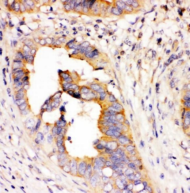 DHFR Antibody in Immunohistochemistry (Paraffin) (IHC (P))