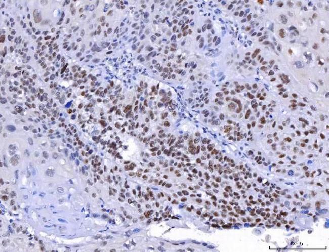 YY1 Antibody in Immunohistochemistry (Paraffin) (IHC (P))