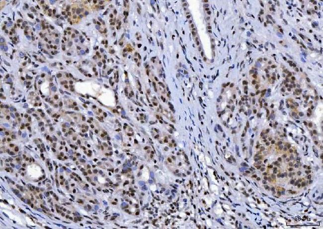 YY1 Antibody in Immunohistochemistry (Paraffin) (IHC (P))