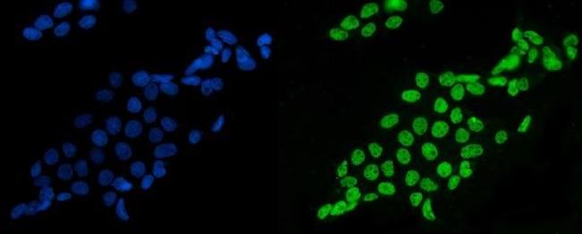 SF1 Antibody in Immunocytochemistry (ICC/IF)