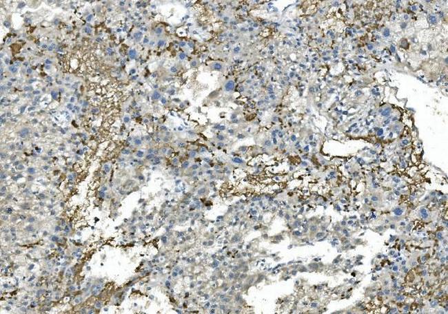 FIBB Antibody in Immunohistochemistry (Paraffin) (IHC (P))