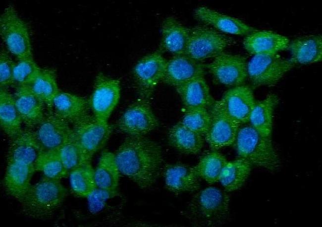 WWOX Antibody in Immunocytochemistry (ICC/IF)