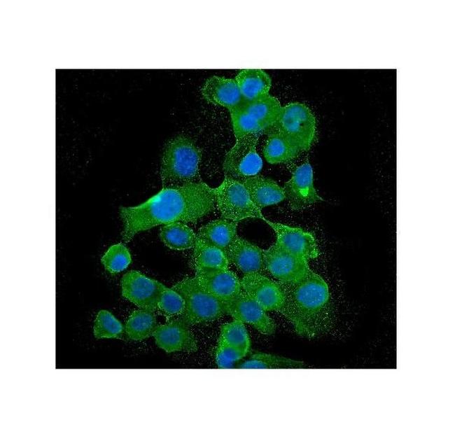 BUBR1 Antibody in Immunocytochemistry (ICC/IF)