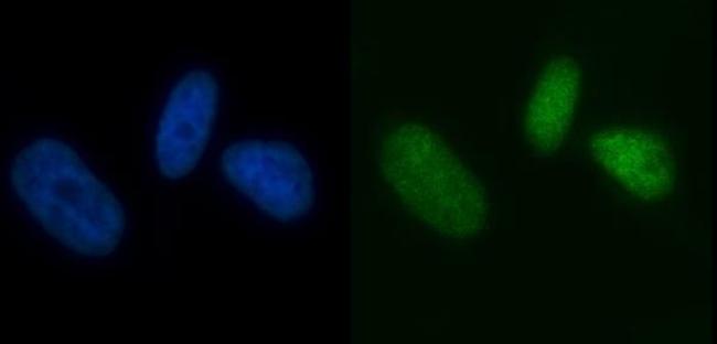 MCM7 Antibody in Immunocytochemistry (ICC/IF)