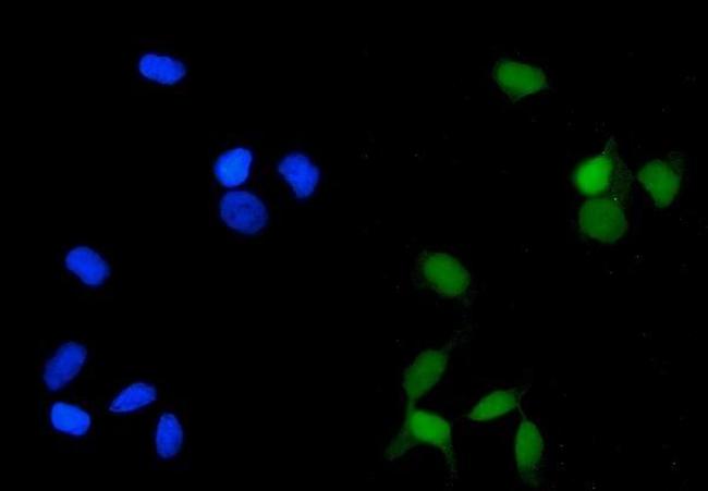 PP2A alpha Antibody in Immunocytochemistry (ICC/IF)