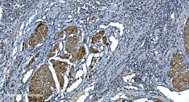 ACTA1 Antibody in Immunohistochemistry (Paraffin) (IHC (P))