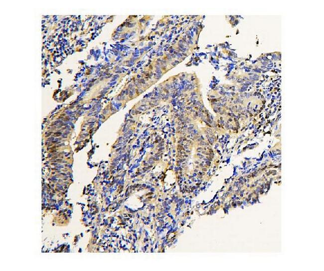 ADK Antibody in Immunohistochemistry (Paraffin) (IHC (P))