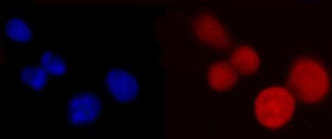 PCBP2 Antibody in Immunocytochemistry (ICC/IF)