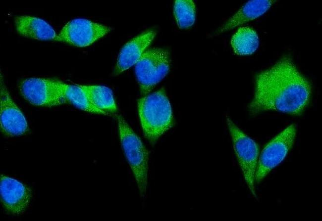 SND1 Antibody in Immunocytochemistry (ICC/IF)