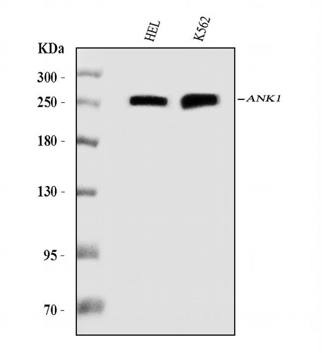 Ankyrin 1 Antibody in Western Blot (WB)