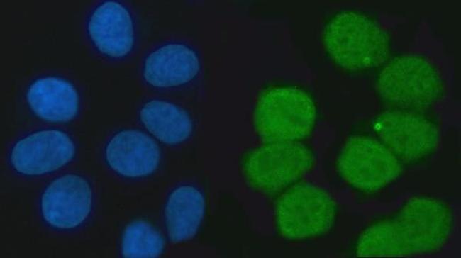 KHSRP Antibody in Immunocytochemistry (ICC/IF)