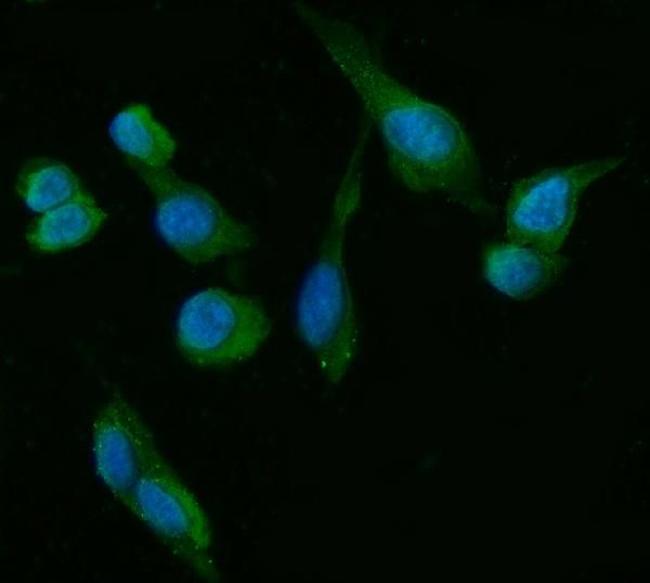 HSD3B1 Antibody in Immunocytochemistry (ICC/IF)