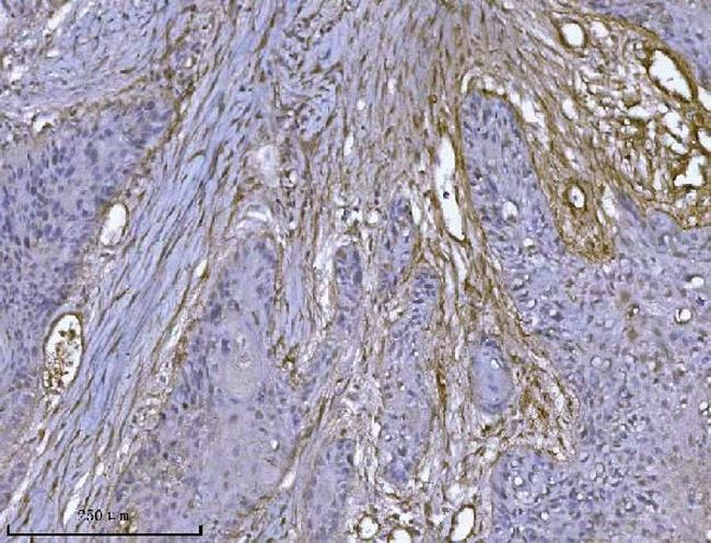 ILK Antibody in Immunohistochemistry (Paraffin) (IHC (P))