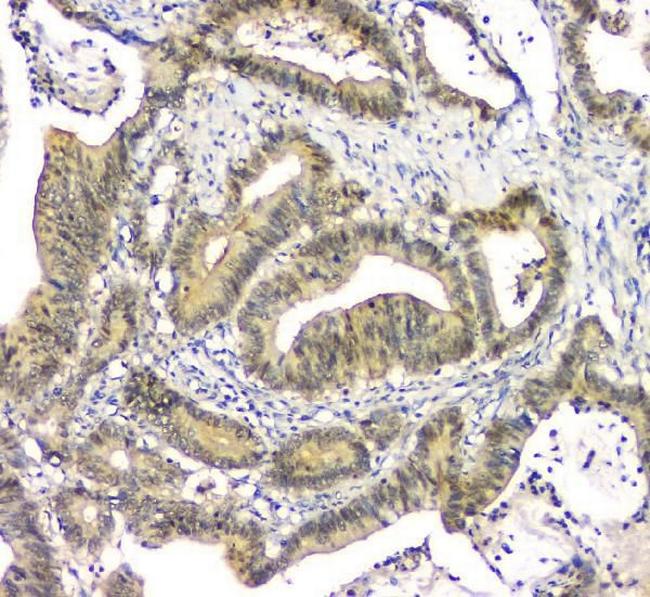 eIF6 Antibody in Immunohistochemistry (Paraffin) (IHC (P))