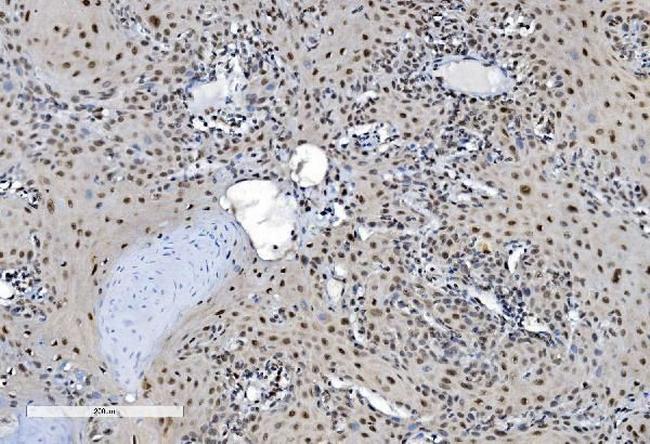 DDX1 Antibody in Immunohistochemistry (Paraffin) (IHC (P))