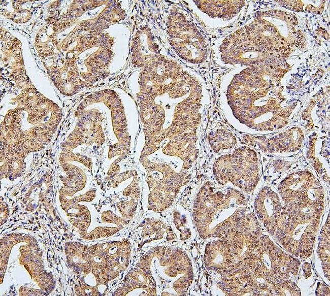 UBA2 Antibody in Immunohistochemistry (Paraffin) (IHC (P))