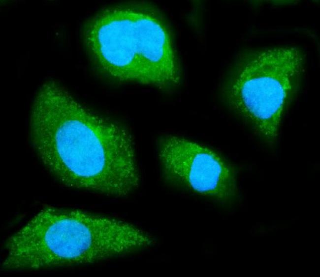 GNB1 Antibody in Immunocytochemistry (ICC/IF)