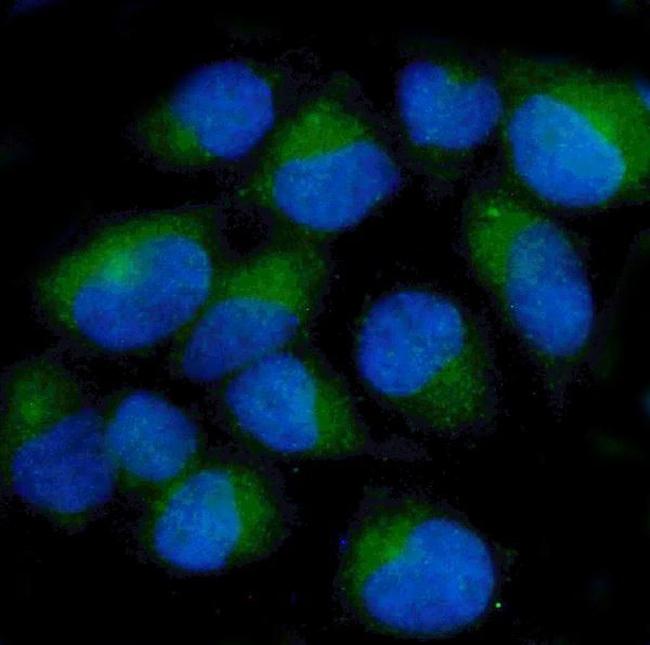 CKAP5 Antibody in Immunocytochemistry (ICC/IF)