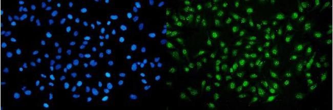 UHRF2 Antibody in Immunocytochemistry (ICC/IF)