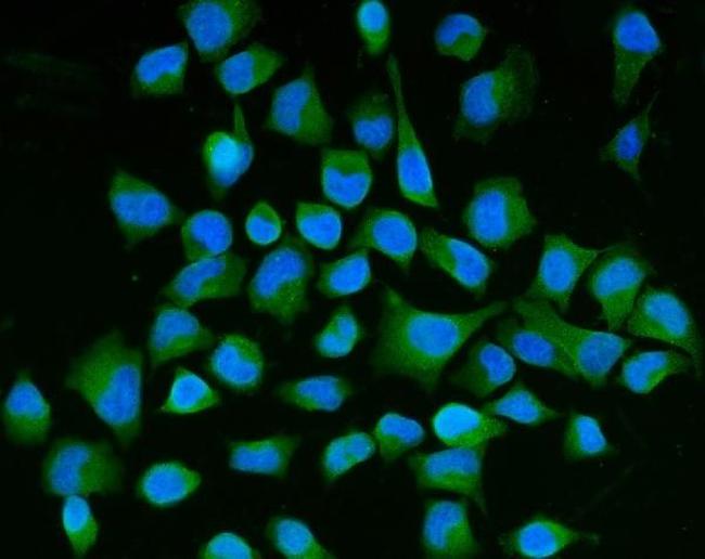 SEMA3B Antibody in Immunocytochemistry (ICC/IF)