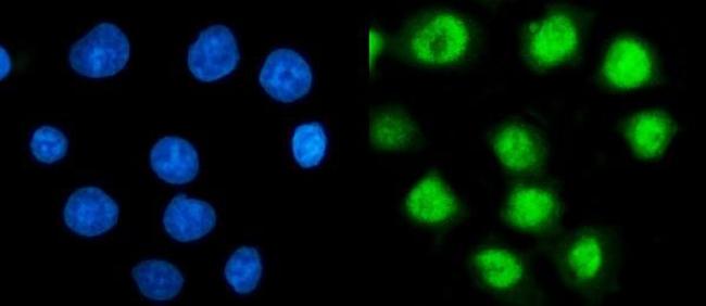 PSMC3 Antibody in Immunocytochemistry (ICC/IF)