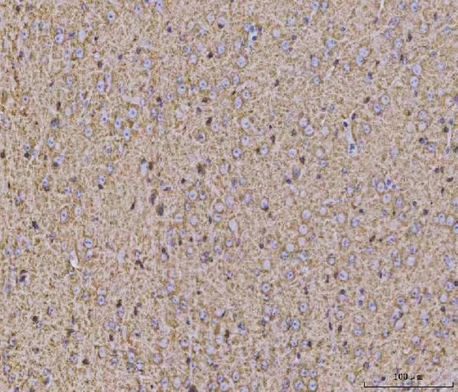 Calcineurin B Antibody in Immunohistochemistry (Paraffin) (IHC (P))