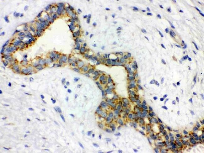 alpha Actinin 2 Antibody in Immunohistochemistry (Paraffin) (IHC (P))