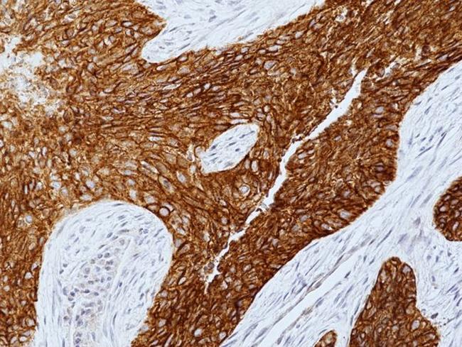 EGFR Antibody in Immunohistochemistry (Paraffin) (IHC (P))