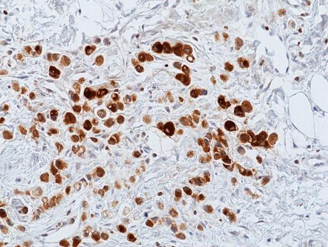 GCDFP-15 Antibody in Immunohistochemistry (Paraffin) (IHC (P))