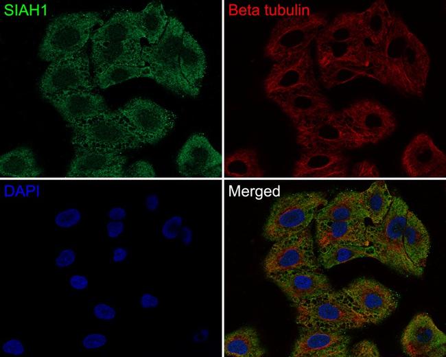 SIAH1 Antibody in Immunocytochemistry (ICC/IF)