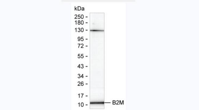 beta-2 Microglobulin Antibody in Western Blot (WB)