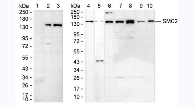 SMC2 Antibody in Western Blot (WB)