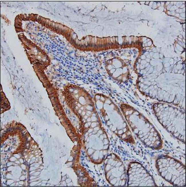 Villin Antibody in Immunohistochemistry (Paraffin) (IHC (P))