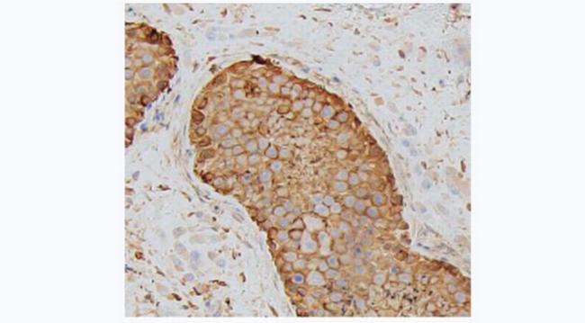 TUBA4A Antibody in Immunohistochemistry (Paraffin) (IHC (P))