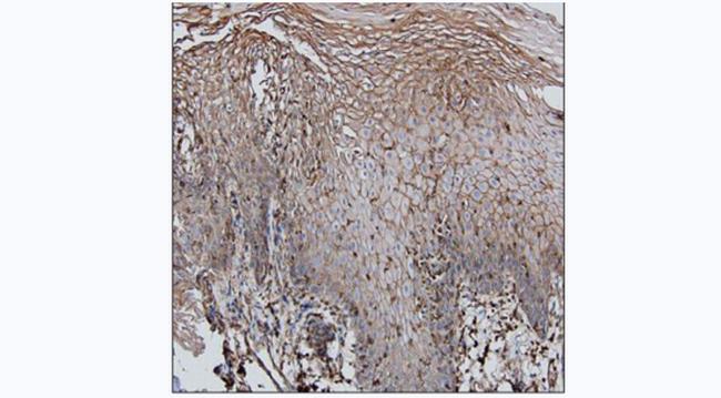 beta Actin Antibody in Immunohistochemistry (Paraffin) (IHC (P))