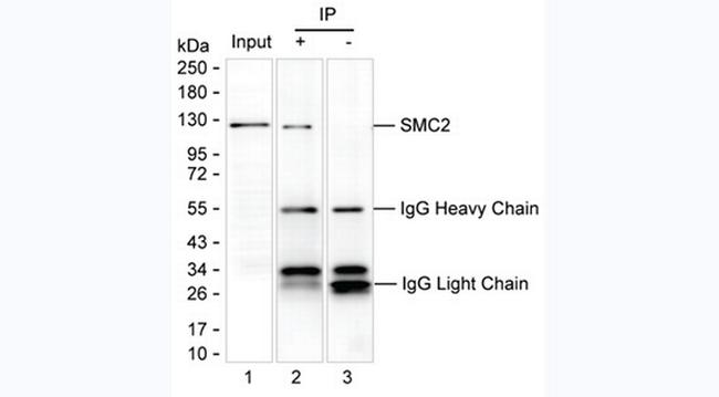 Acetyl-SMC2 (Lys114) Antibody in Immunoprecipitation (IP)