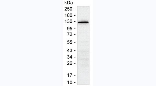 Acetyl-SMC2 (Lys114) Antibody in Western Blot (WB)