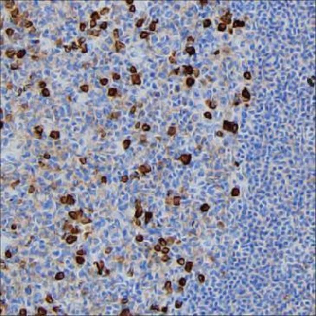 J Chain Antibody in Immunohistochemistry (Paraffin) (IHC (P))