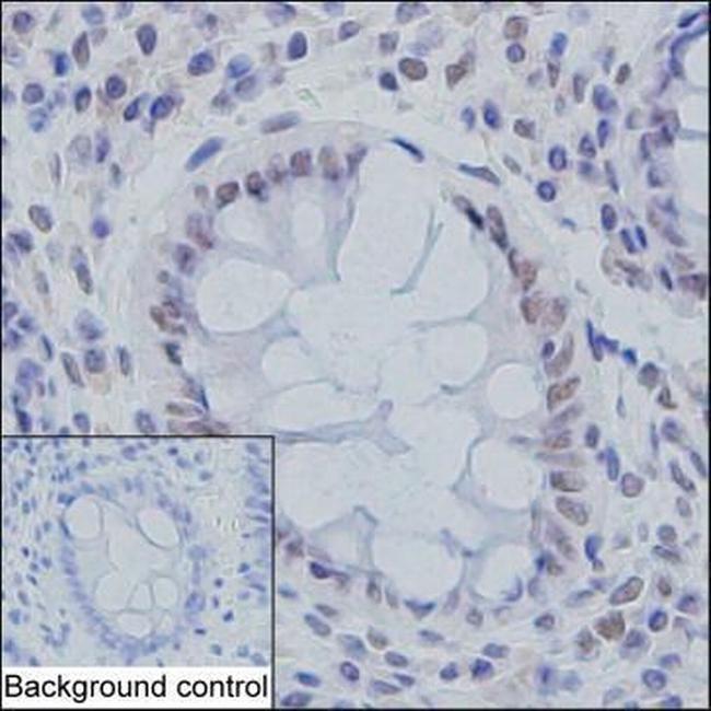 SMC3 Antibody in Immunohistochemistry (Paraffin) (IHC (P))