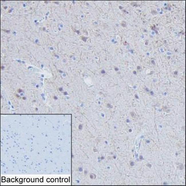 RAB11B Antibody in Immunohistochemistry (Paraffin) (IHC (P))