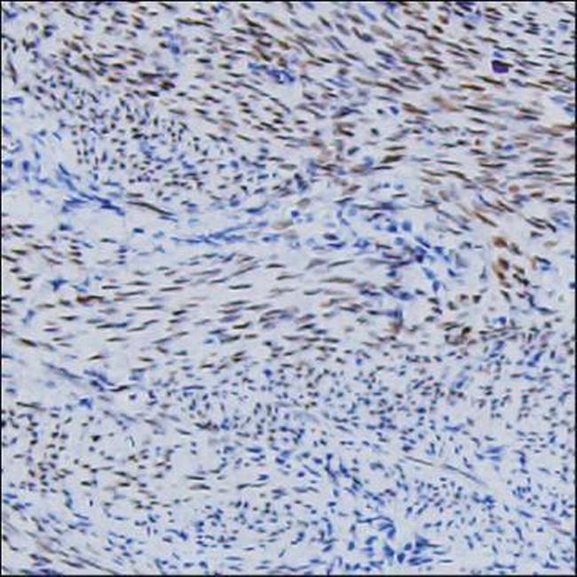 FGF2 Antibody in Immunohistochemistry (Paraffin) (IHC (P))