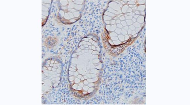 PIGR Antibody in Immunohistochemistry (Paraffin) (IHC (P))