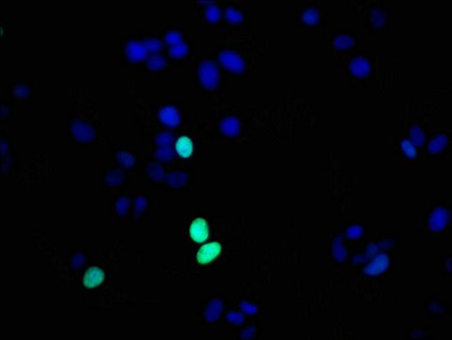 Phospho-Histone H1.4 (Thr17) Antibody in Immunocytochemistry (ICC/IF)