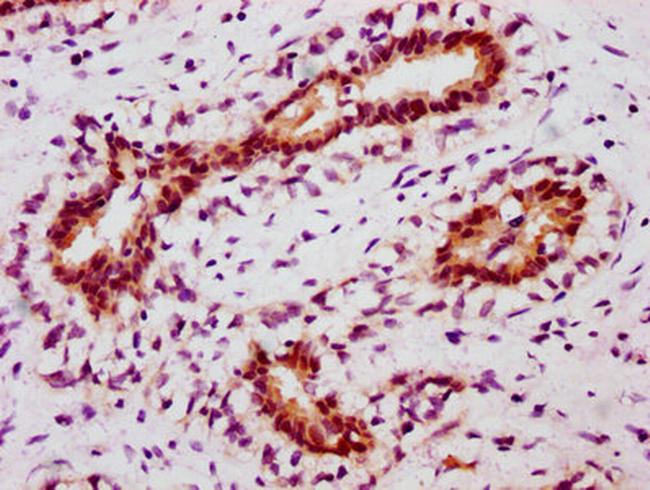 Phospho-STAT5 alpha (Tyr694) Antibody in Immunohistochemistry (Paraffin) (IHC (P))