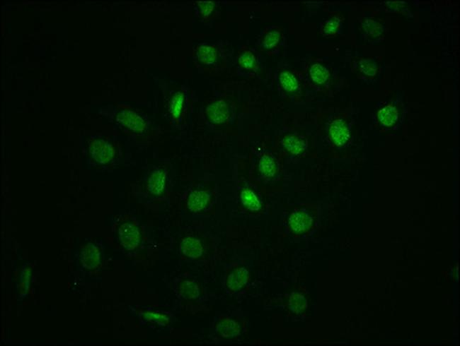 Phospho-IkB alpha (Ser32) Antibody in Immunocytochemistry (ICC/IF)