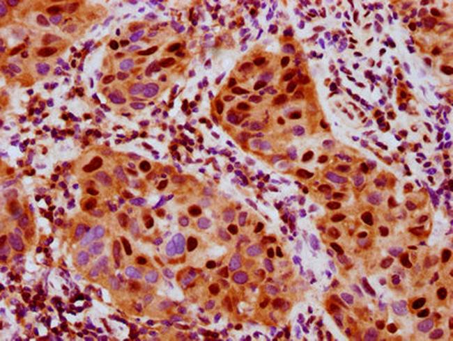 Phospho-MSK1 (Ser376) Antibody in Immunohistochemistry (Paraffin) (IHC (P))