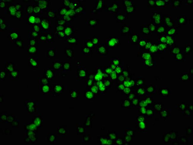 Phospho-Rb (Ser780) Antibody in Immunocytochemistry (ICC/IF)